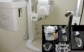 3D-CT