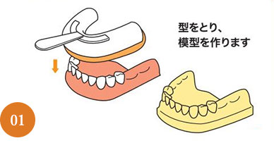 義歯治療の流れ