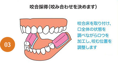 義歯治療の流れ