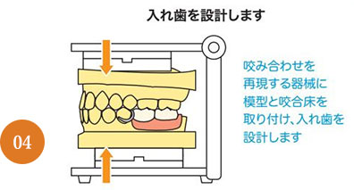 義歯治療の流れ