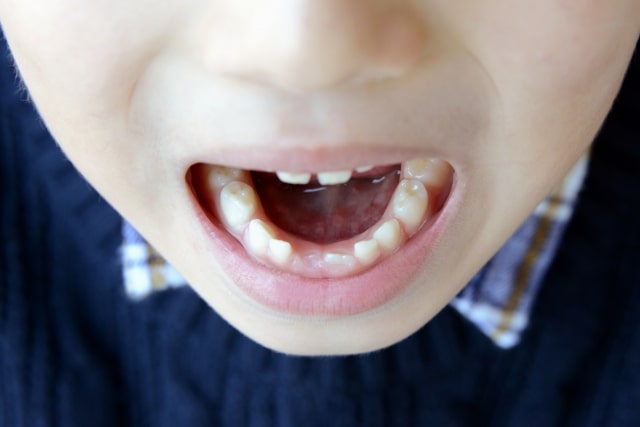 子供の歯